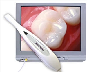 Intraoral Camera